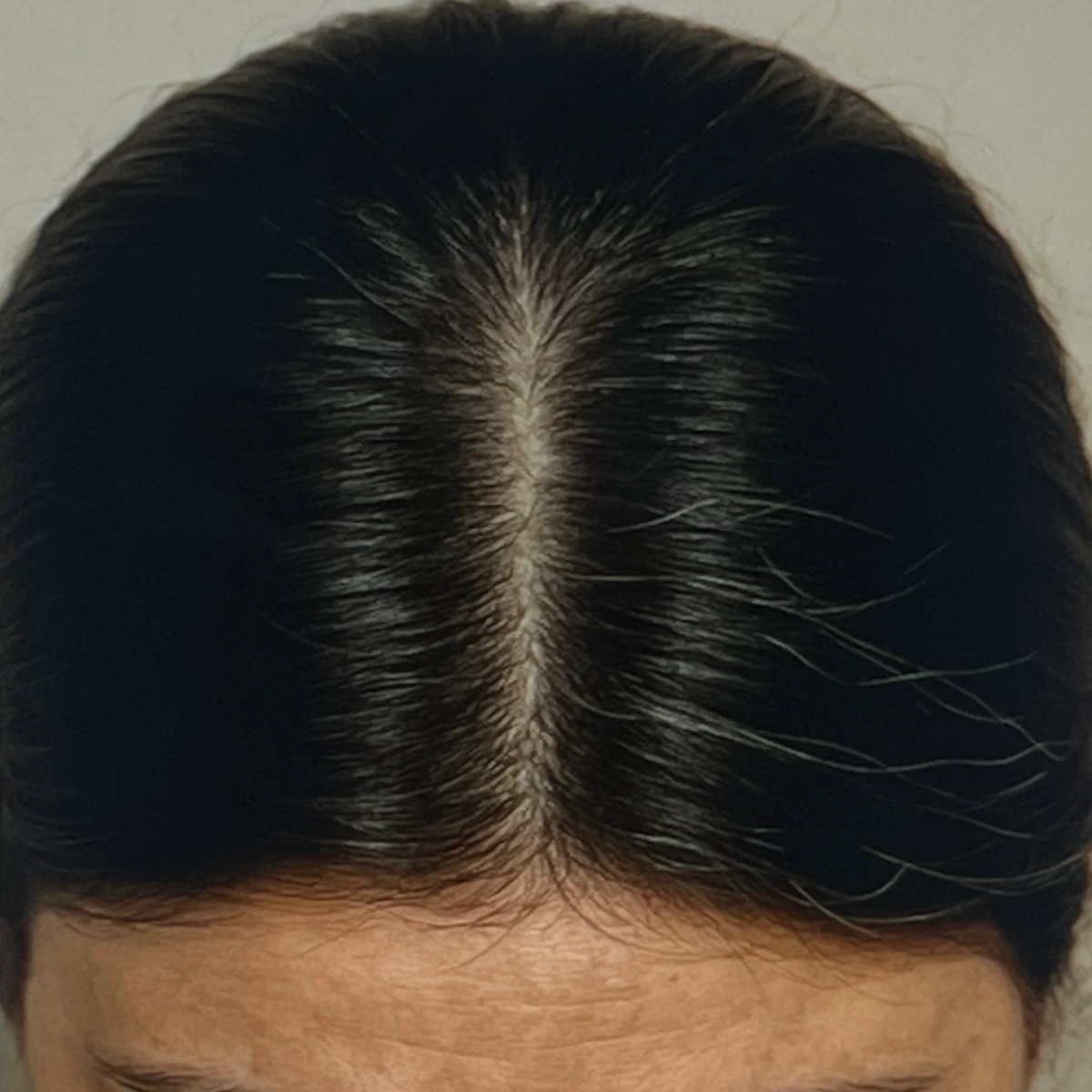 포리쥬nmn-흰머리-효과-후기-내돈내산-글-작성위해-찍은-내-모발-사진