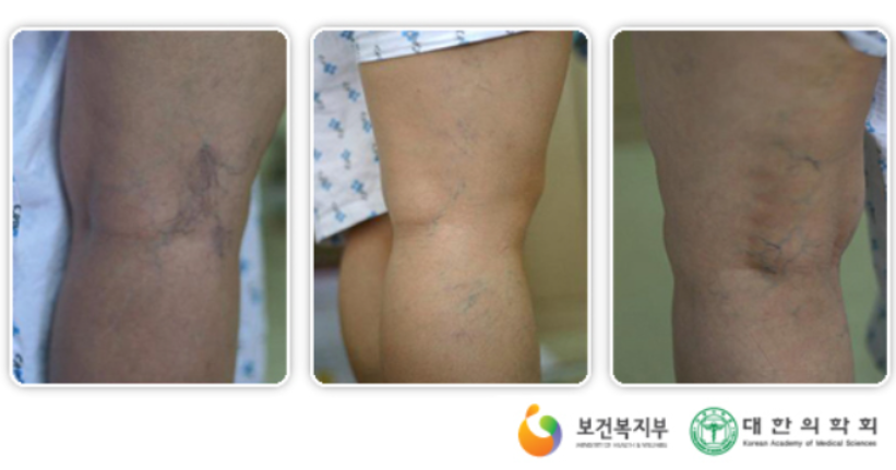 노화가 빨라지는 증거, 이런 증상 나타난다면?