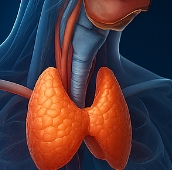 갑상선 기능 저하증