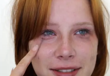 췌장암 초기증상 9