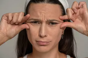 안검하수 수술비용