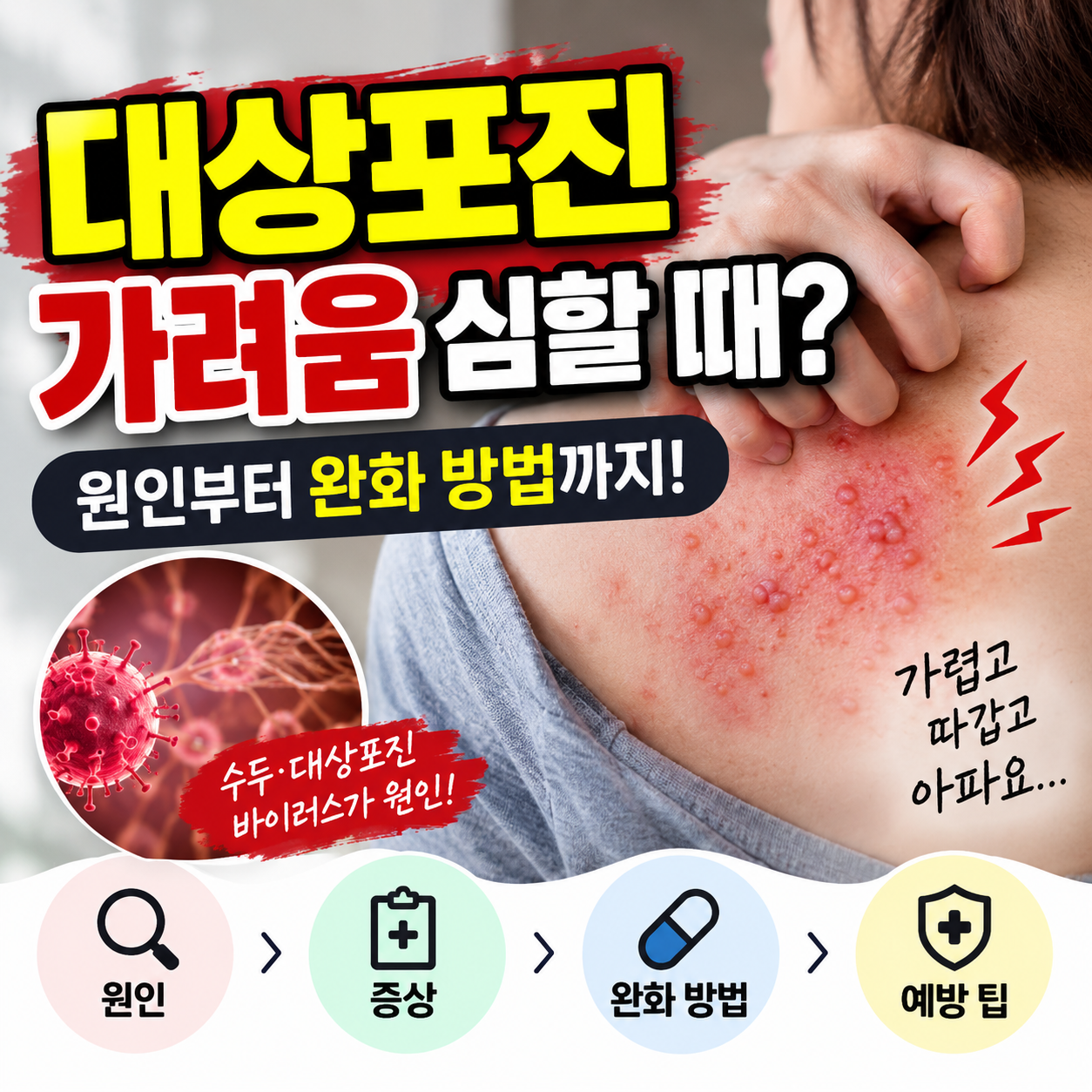 대상포진 가려움 심할 때? 원인부터 완화 방법