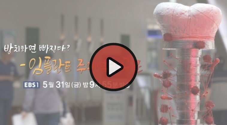 EBS 명의 임플란트 재방송