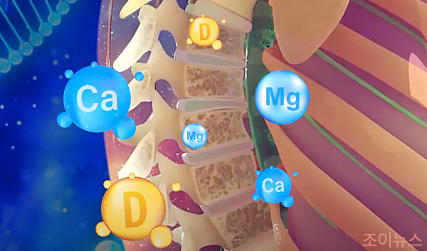 골밀도 검사의 목적