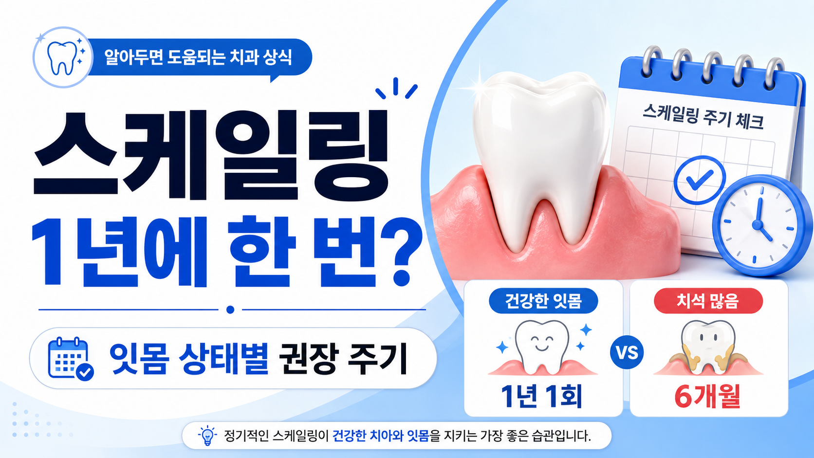 스케일링 1년에 몇 번 받아야 하는지 설명하는 썸네일