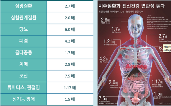 잇몸병 있으면 성기능장애 위험 1.5배 -부분별위험도