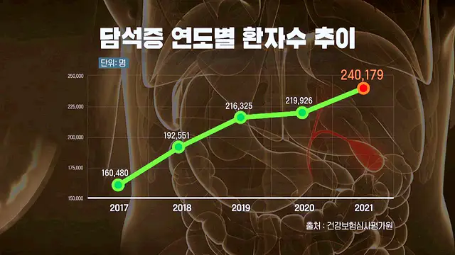명의 더부룩한 소화불량의 경고 담낭 담도암 담석증 용종 담도 질환 예방 방법 병원 추천 소개