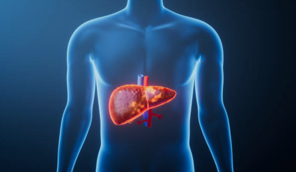 간암과 관련된 사진1