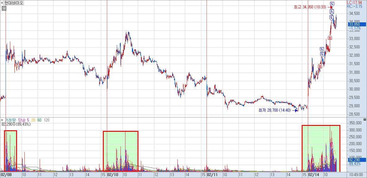 현대바이오 차트 예시 1)