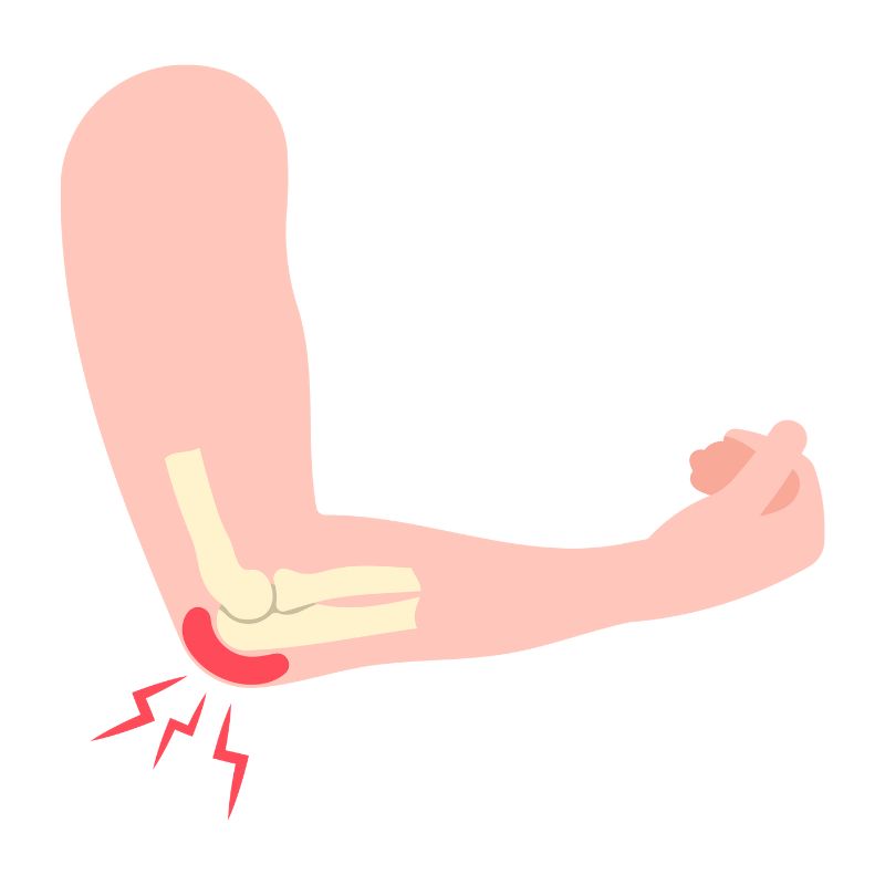 팔꿈치 붓기