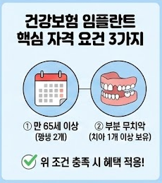 건강보험 임플란트