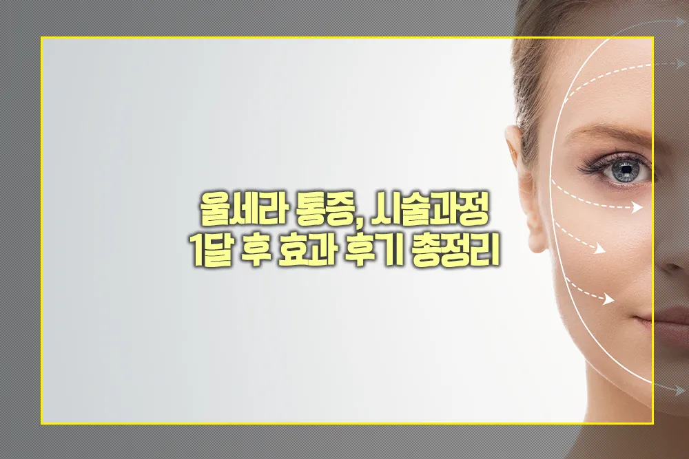 울세라 통증 시술과정 1달 후 효과 후기