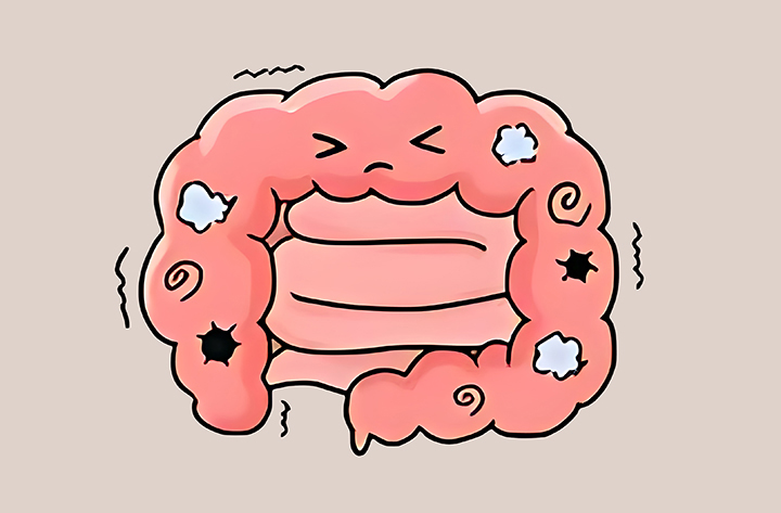 소화-불량-증상을-보이는-장의-모습