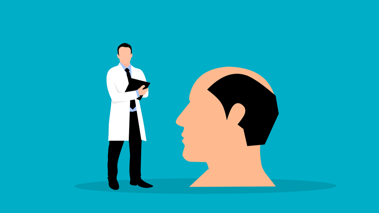 중년 남성의 탈모 원인과 효과적인 치료 방법