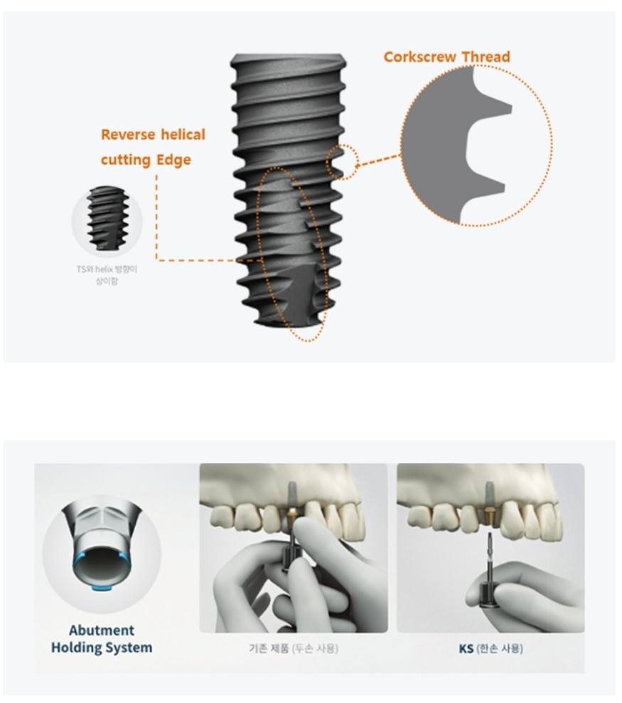 오스템 임플란트 KS System 제품 구조 및 체결방식