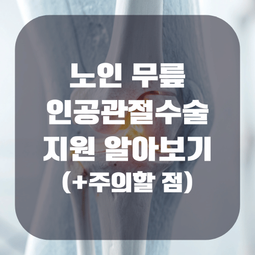 노인 무릎 인공관절 수술 지원 알아보기