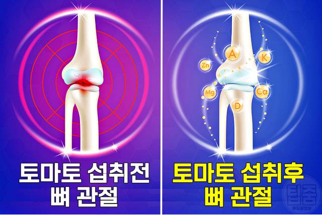 토마토효능 토마토 매일 먹으면 골다공증 뼈