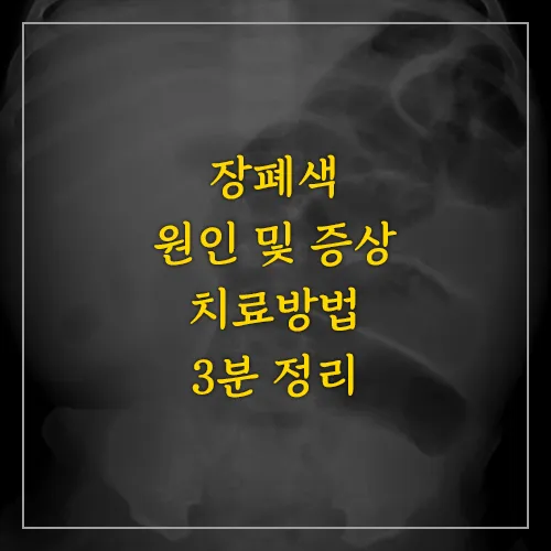 장폐색-원인-및-증상-치료방법-썸네일