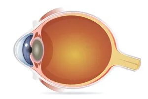 렌즈삽입술-가격