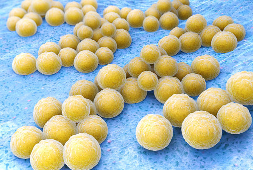 독성 쇼크 증후군과 관련된 사진1