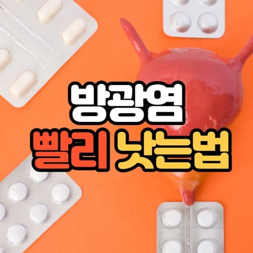 방광염 빨리 낫는법