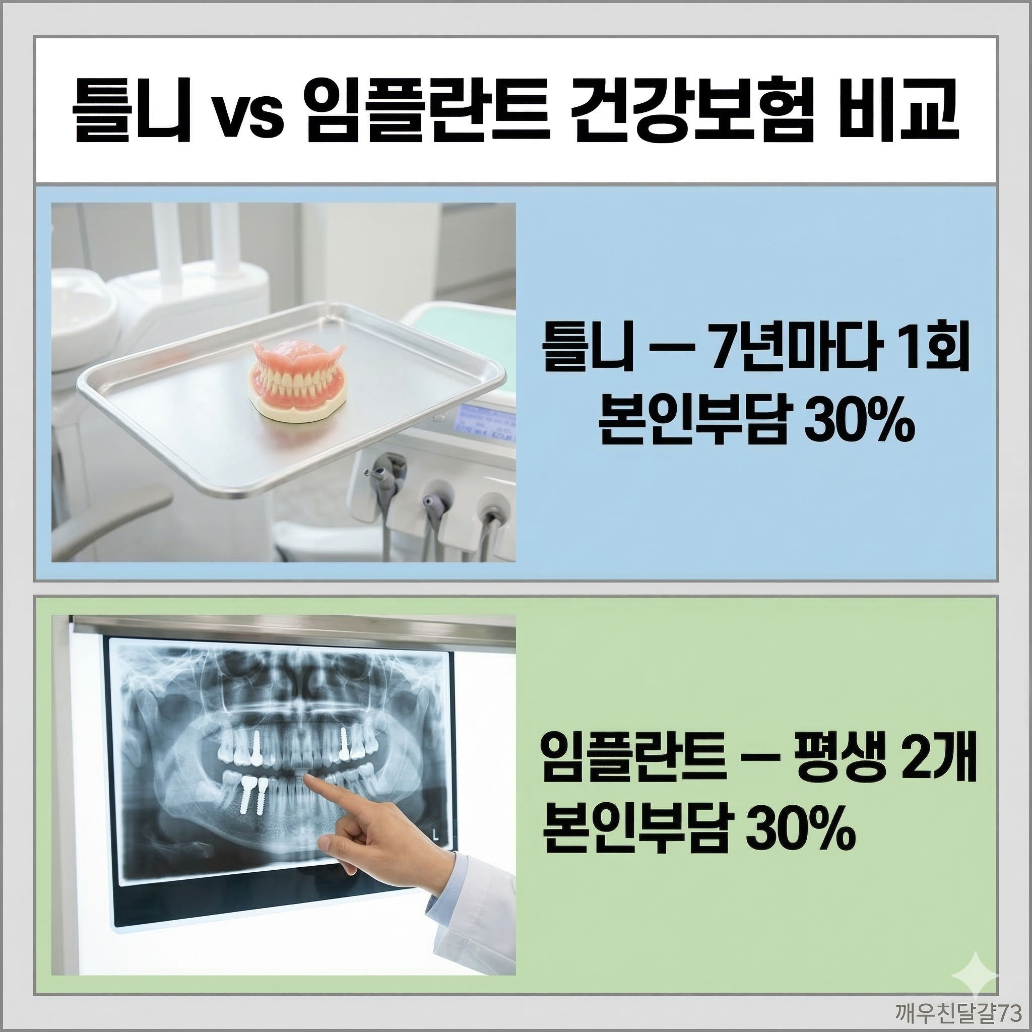 노인 틀니·임플란트 건강보험 적용 총정리 (65세 이상 본인부담 30%)