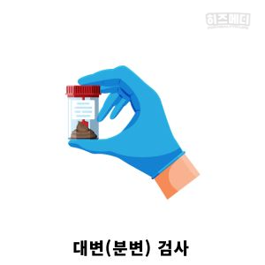 과민성 대장 증후군 진단 치료