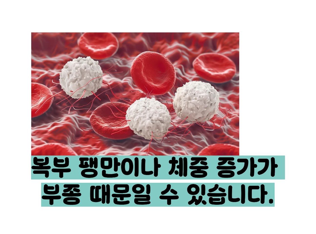 알부민 수치 낮으면