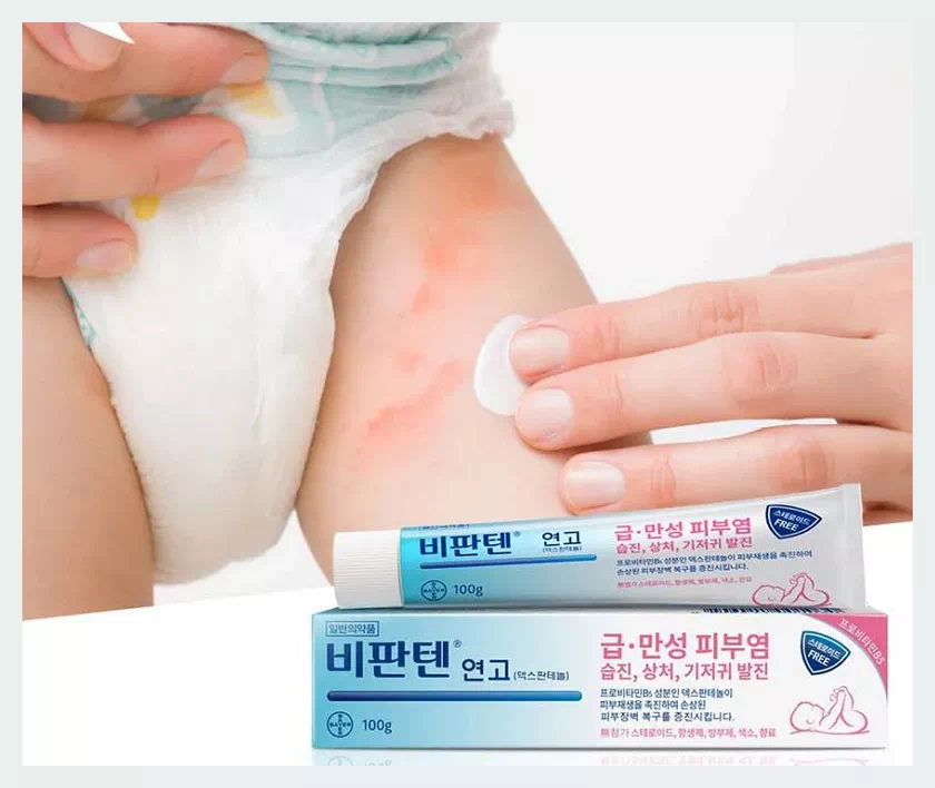 비판텐 연고: 기저귀 발진