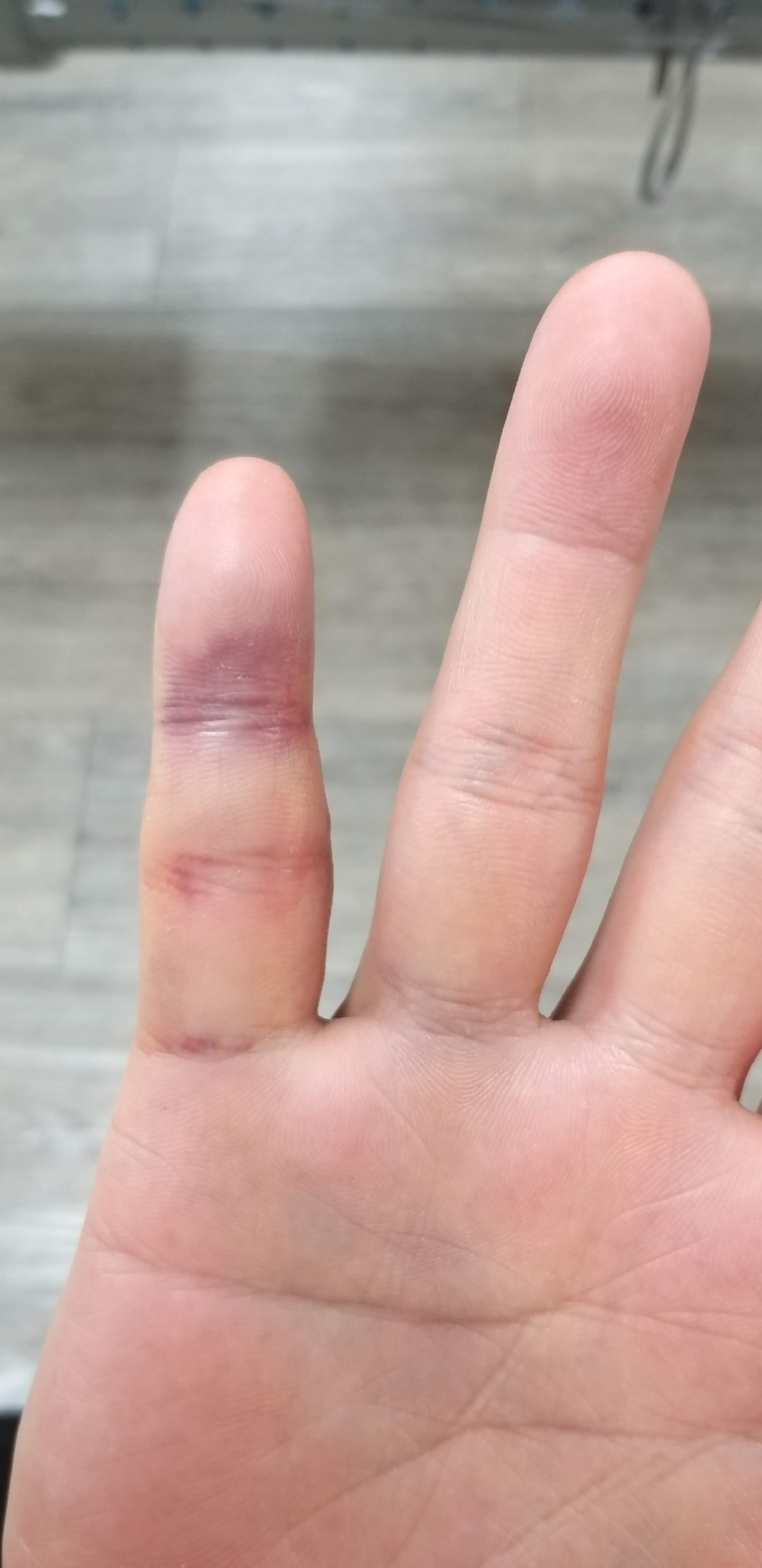 1월22일부은손가락사진1