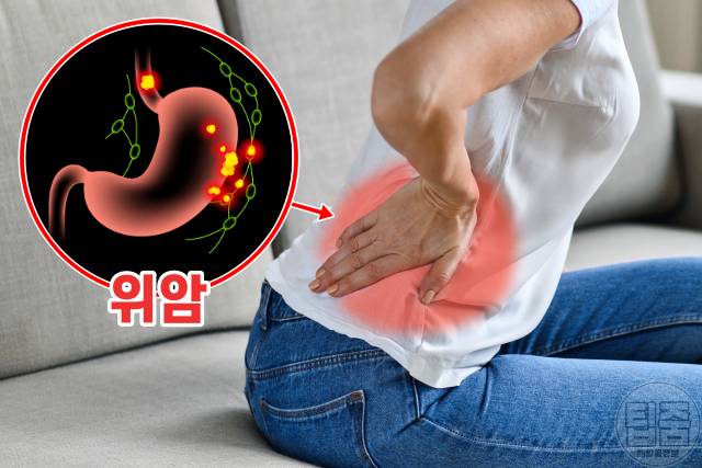 위암 증상,위암 초기증상 자가진단,등통증,위암전이