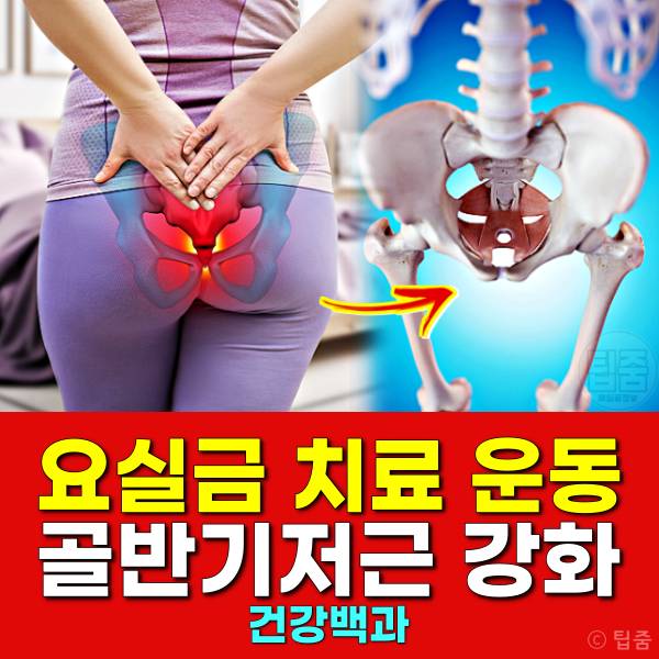 요실금 치료 운동 골반기저근 운동