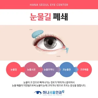 눈물이 자주 나는 이유에 대한 안과정보_2