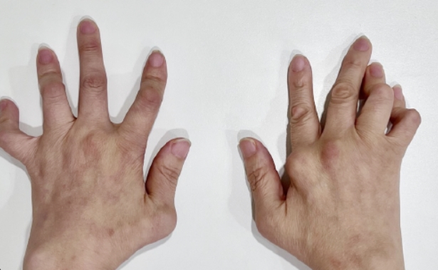 60대 관절염 예방하는 확실한 방법 - 무릎 건강 지키는 생활 습관