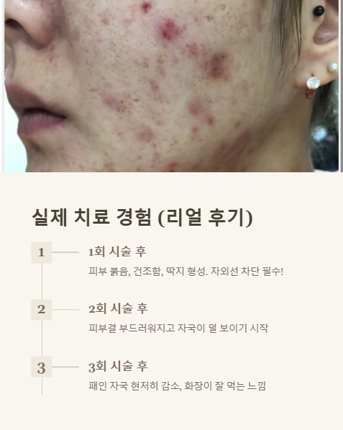 실제 치료 경험