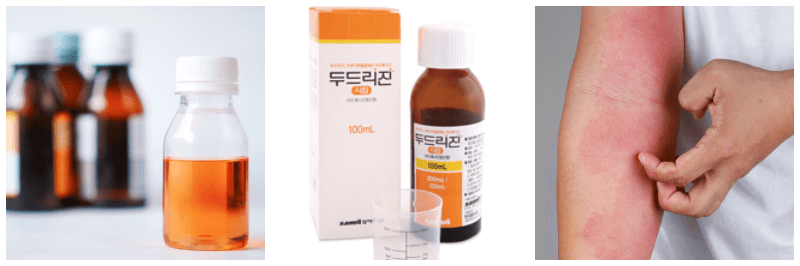 두드리진 시럽, 두드러기 사진