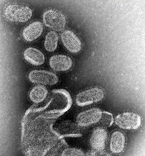 인플루엔자-무료 예방접종-시기-예약-가격-65세이상-어린이-임산부