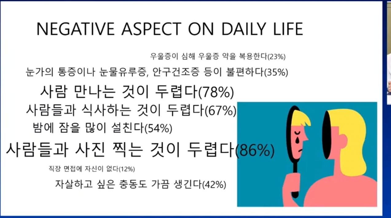 EBS-명의-구안와사-안면마비-
