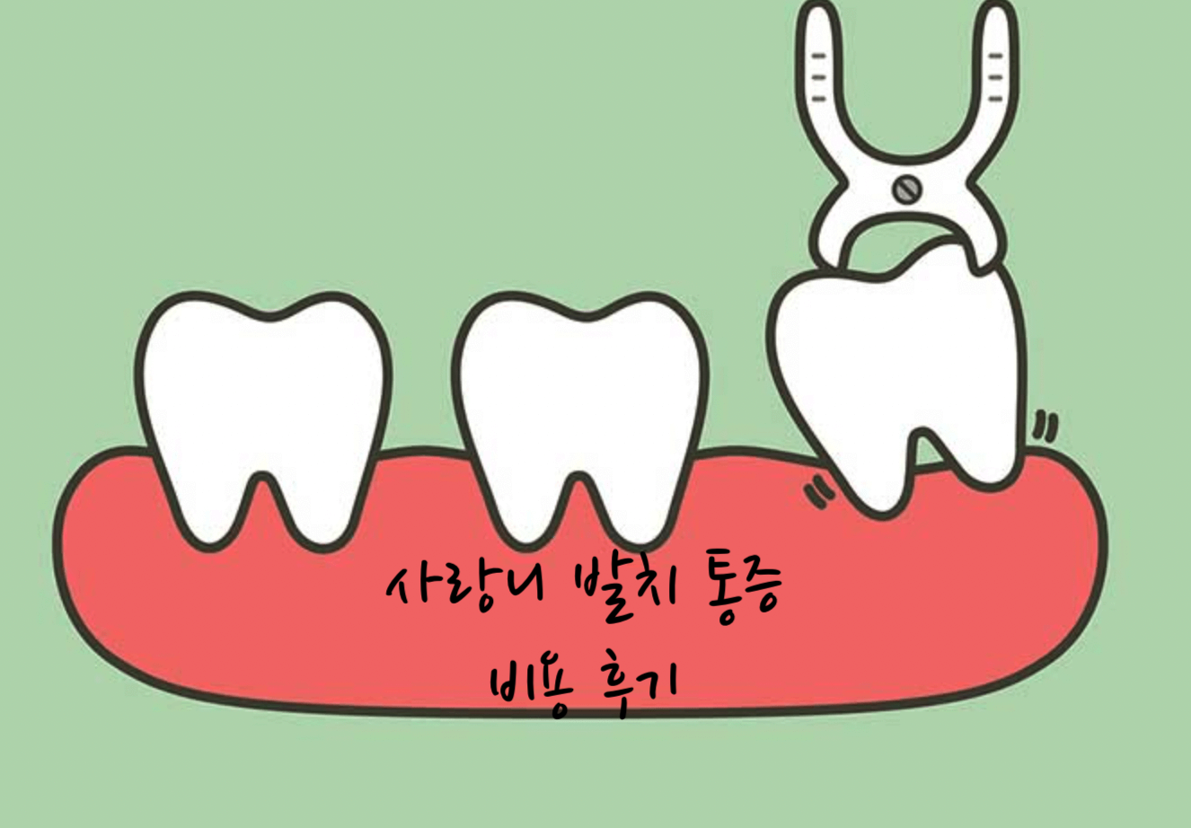 사랑니 발치
