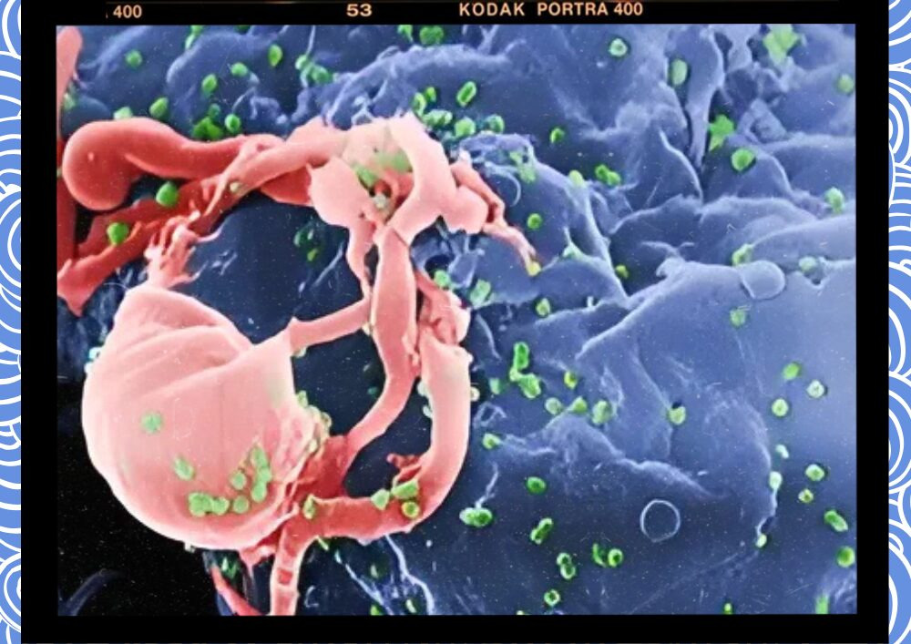HIV 감염에 대한 사회적 기피 현상이 강하여 젊은 층이 증상이 의심되어도 주변의 시선과 경제적 부담 때문에 선뜻 검사를 받으러 가지 않는 점도 조기 진단 및 치료를 어렵게 하고 있습니다.