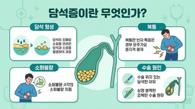 담낭 제거 수술 담낭 역할 담즙 소화 설명