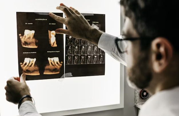 잇몸이 내려 앉을 때 해결법