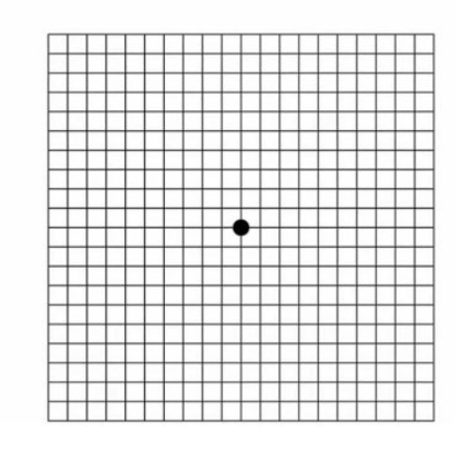 황반변성 자가진단, 치료법, 주사치료 가격