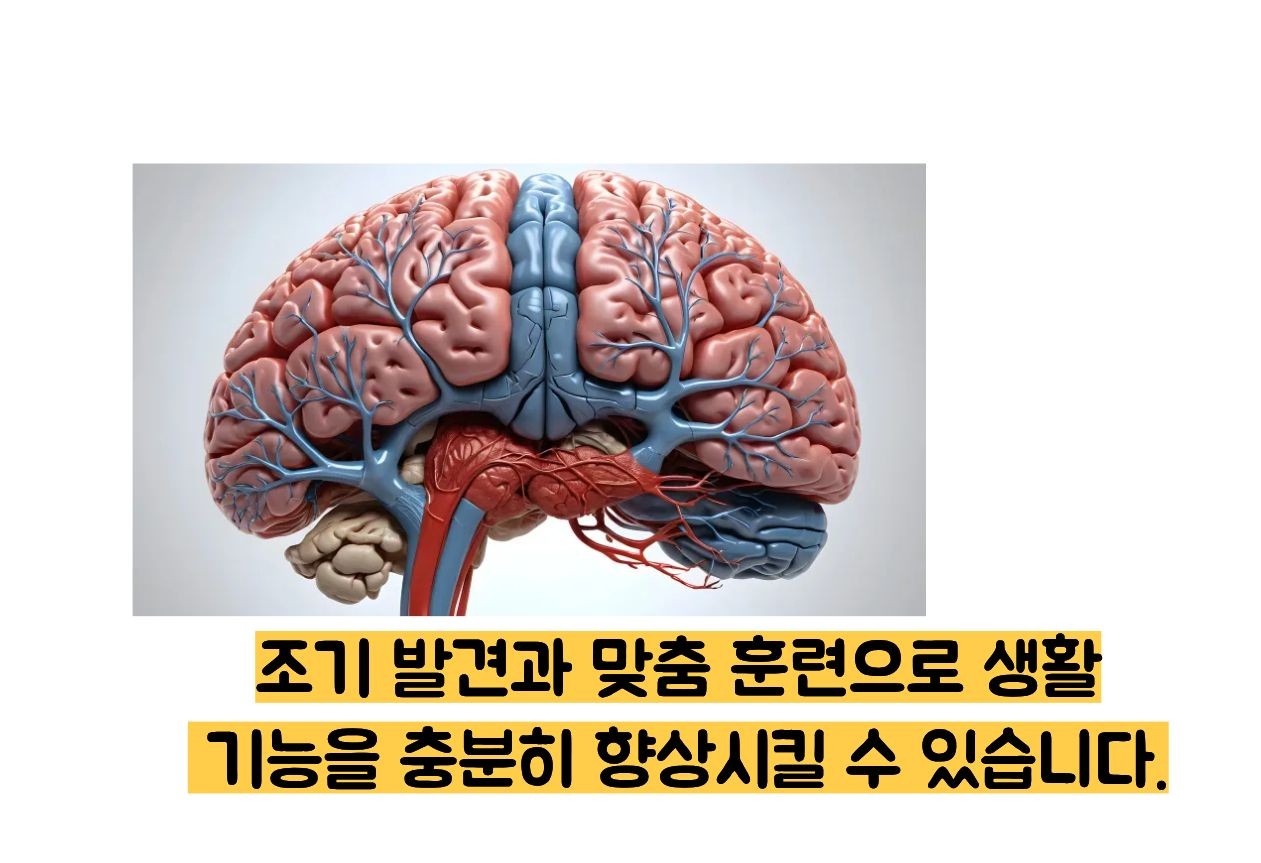경계성 지능장애란