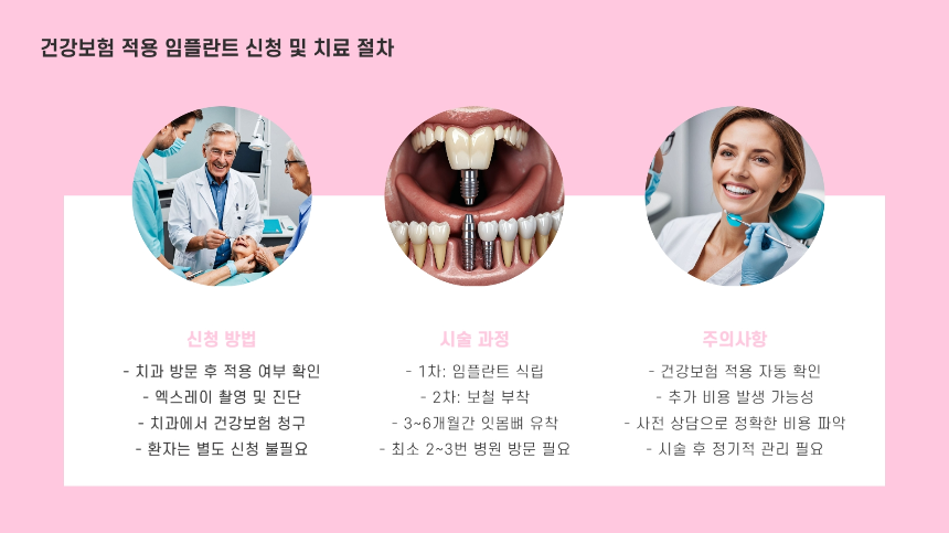 2025년 임플란트 건강보험 적용 기준 – 비용 절감할 수 있는 방법 총정리!