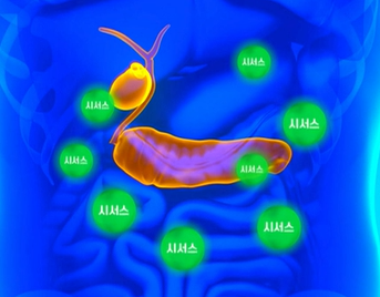 시서스 효능