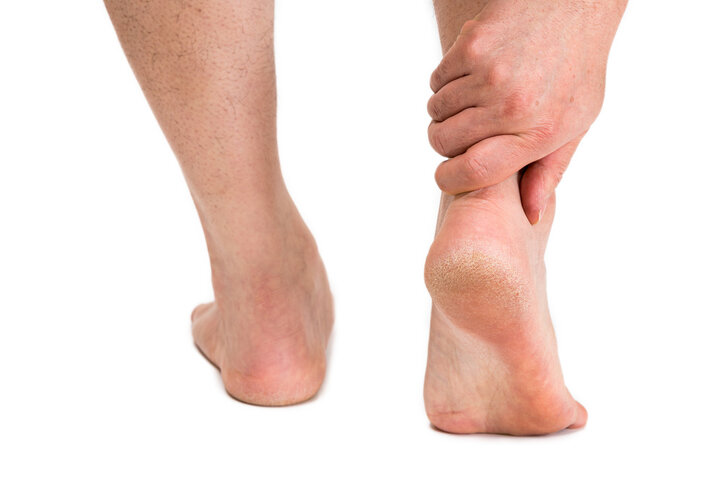 발등이 붓는 이유, 발등이 부어오르는 이유 알아보기