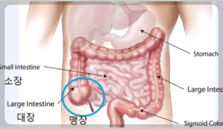 맹장의 위치