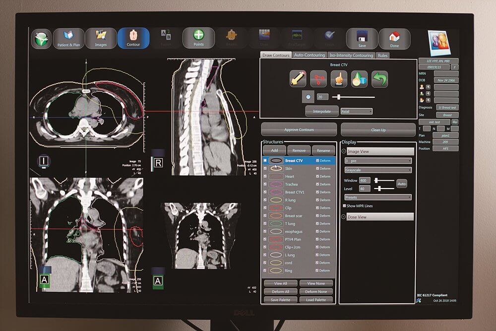 전신 방사선 치료법