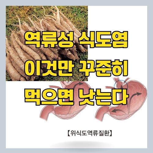 역류성식도염으로 속이 쓰리신분께 한의사가 추천하는 한방 약차와 레시피